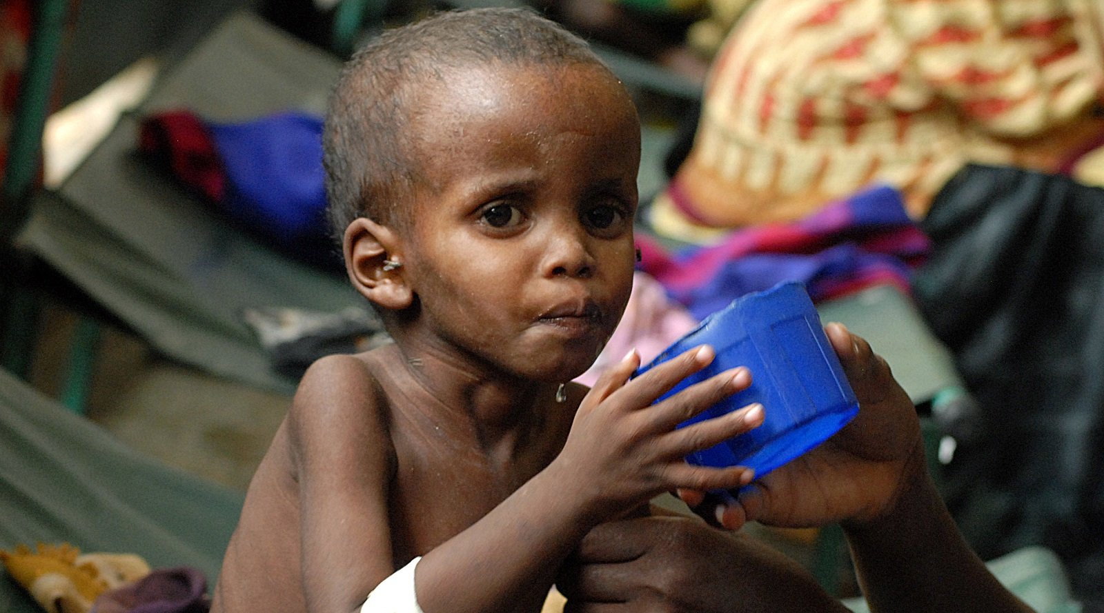 the-epidemic-of-under-nutrition-haunts-india-s-cities-and-towns-newsclick